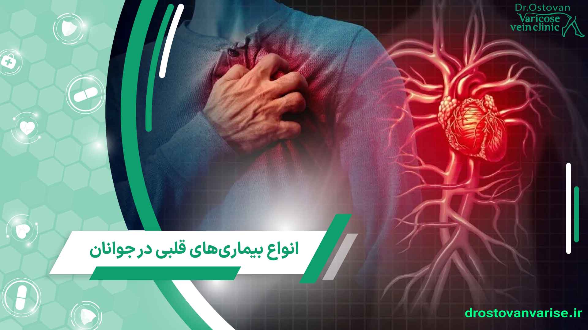 انواع بیماری های قلبی در جوانان
