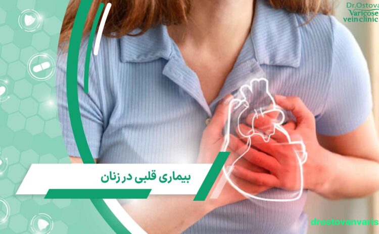 پیشگیری از بیماری قلبی در زنان جوان