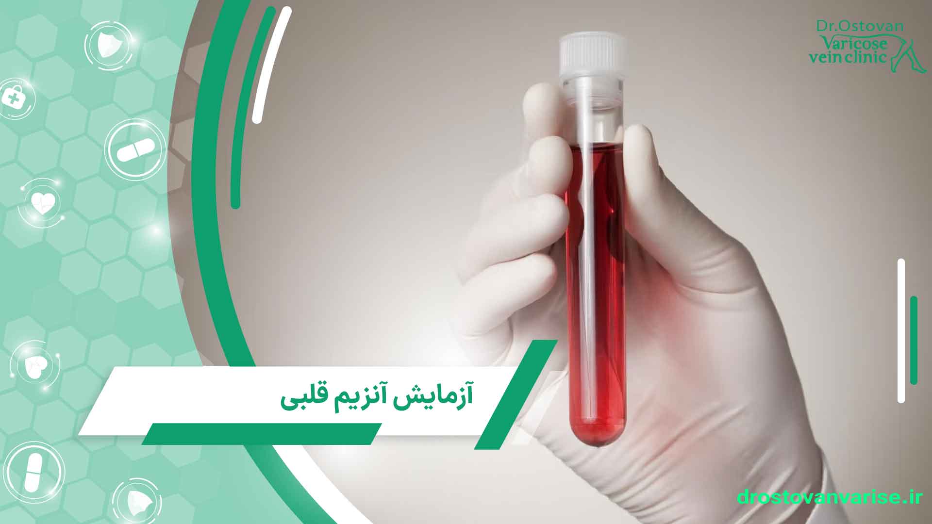 آزمایش آنزیم قلبی چیست